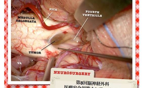 第三回脳神経外科医療安全対策カンファランス | 富山大学医学部脳神経外科