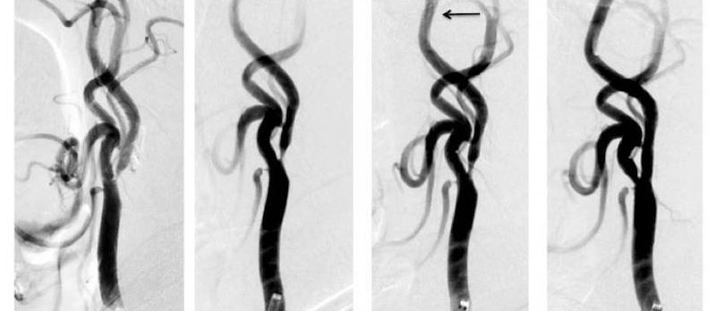 ニューロサイエンスの旅 Vol.24 | 富山大学医学部脳神経外科